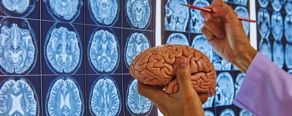 Fate on the Human Brain—The Answer Science Could Never Grasp